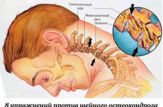 Восемь упражнений против шейного остеохондроза