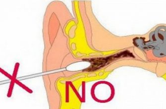 Как правильно и безопасно чистить уши в домашних условиях