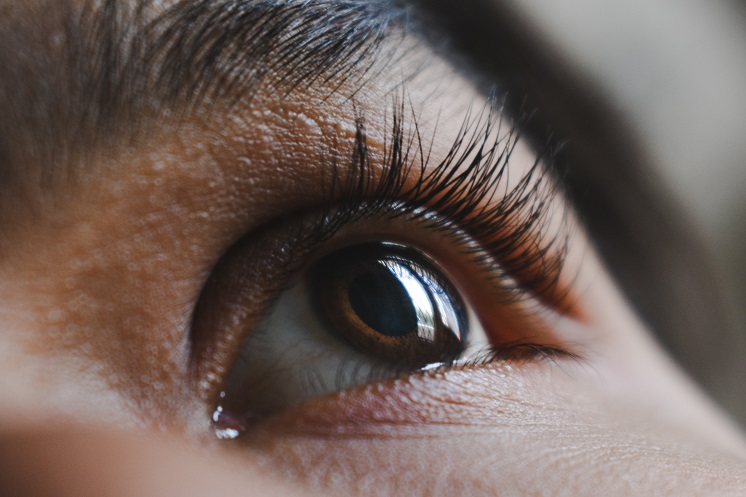 Как быстро снять покраснение глаз в домашних условиях