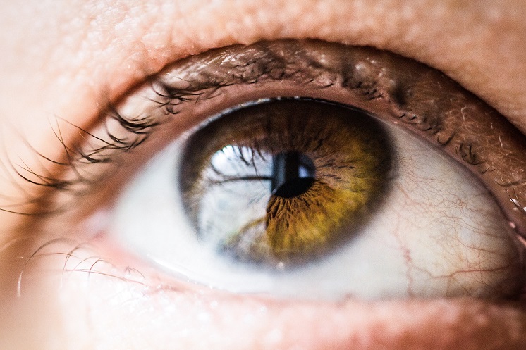 Как быстро снять покраснение глаз в домашних условиях