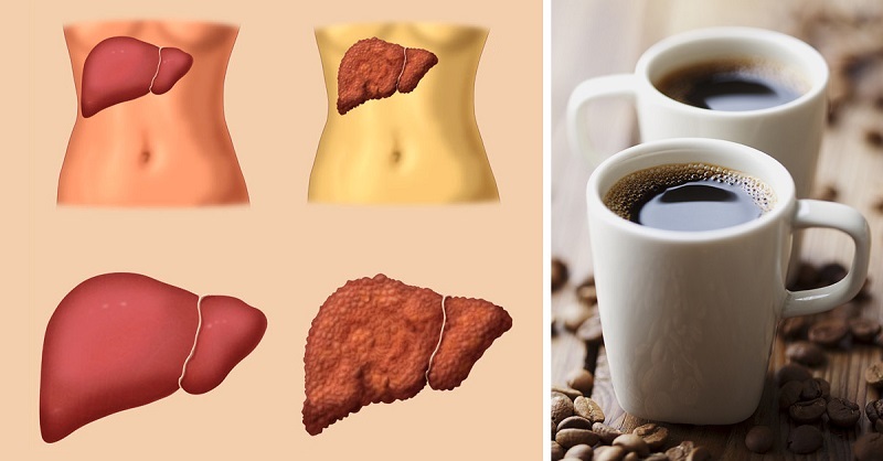 5 страшных болезней, при которых положено пить кофе! Обязательная чашка каждый день. Не слышал раньше о таком действии…