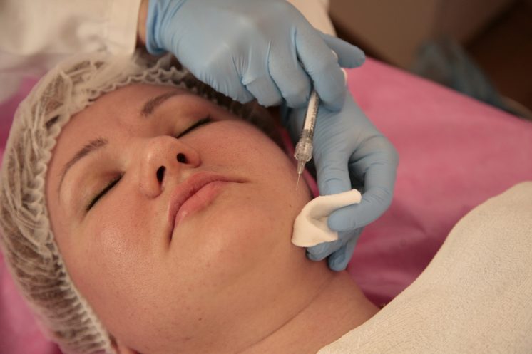 Биоревитализация кожи лица гиалуроновой кислотой: 10 причин сделать процедуру