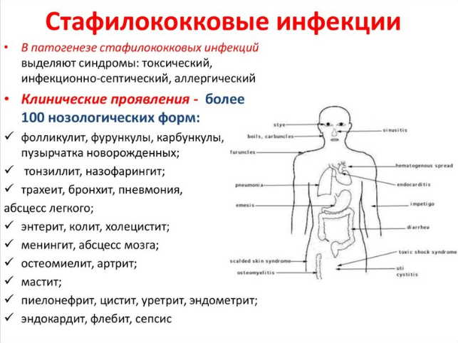 Стафилококк боится череды и эвкалипта: народное лечение стафилококковых инфекций на коже и слизистых