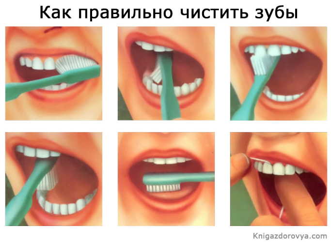 Как избежать проблем с зубами: советы стоматолога