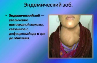 Чтобы исчез зоб нужно потрудиться — сделать настойку, и не лениться!