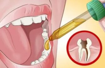 Стоматолог просто не поверил, когда узнал как пациент избавился от зубной боли