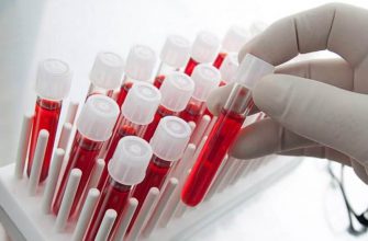 Основные анализы, которые стоит делать, чтобы быть спокойным за свое здоровье