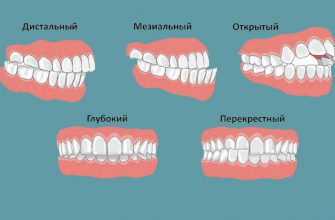 Важно знать! Связь прикуса и проблем с опорно-двигательным аппаратом