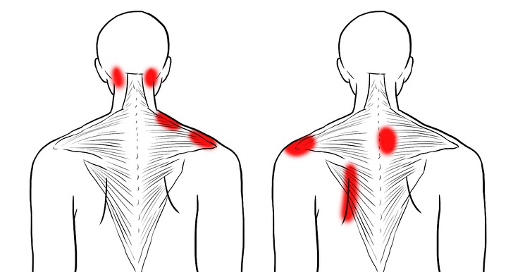 11 упражнений для снятия напряжения в шее и плечах