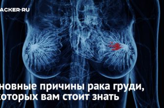 Главные причины Рака ГРУДИ, о которых редко говорят, но их нужно знать