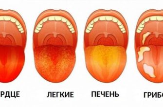 3 вещи, которые ваш язык пытается рассказать о вашем здоровье