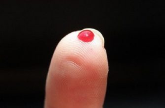 Эффективный метод спасения от инсульта