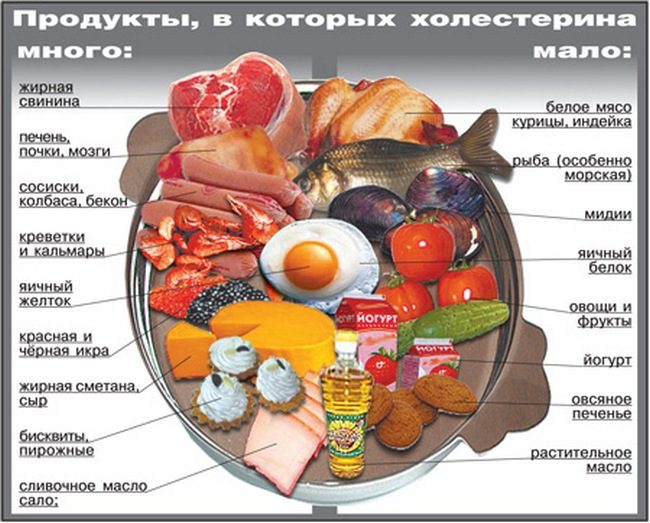 Что такое холестерин, и откуда берутся холестериновые бляшки?