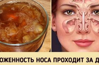 Быстро и просто избавиться от заложенного носа вам поможет этот луковый сироп!