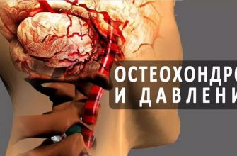 Шейный остеохондроз и высокое давление как неразлучная парочка