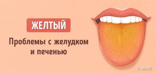 Цвет языка при панкреатите фото