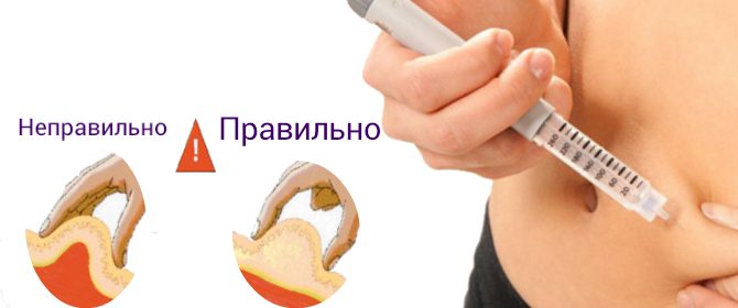 Как сделать укол самому себе