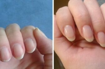 Как быстро отрастить ногти, которые никогда не сломаются: поможет простое средство из 4 компонентов!