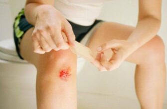 6 домашних средств для быстрого заживления язв на коже ног