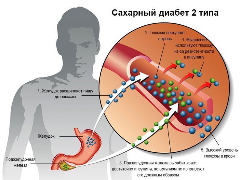 О чём может рассказать потемневшая кожа на локтях