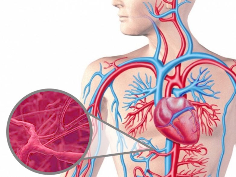 Что нужно знать о воспалении сосудов
