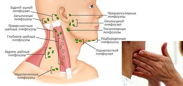 Где на шее находятся лимфоузлы схема расположения